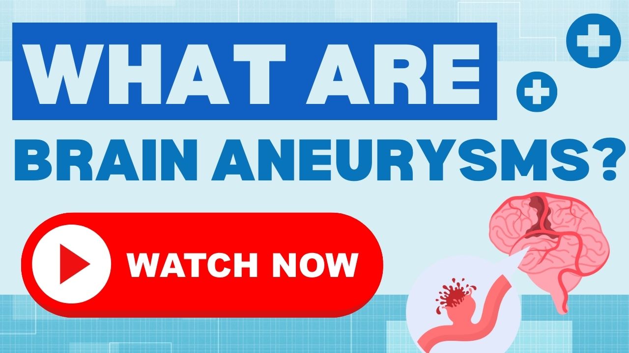 Brain Aneurysms